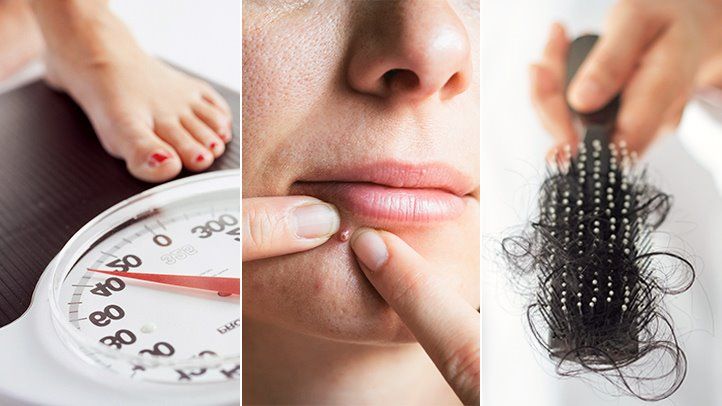 pcos-symptoms-and-diagnosis-722x406